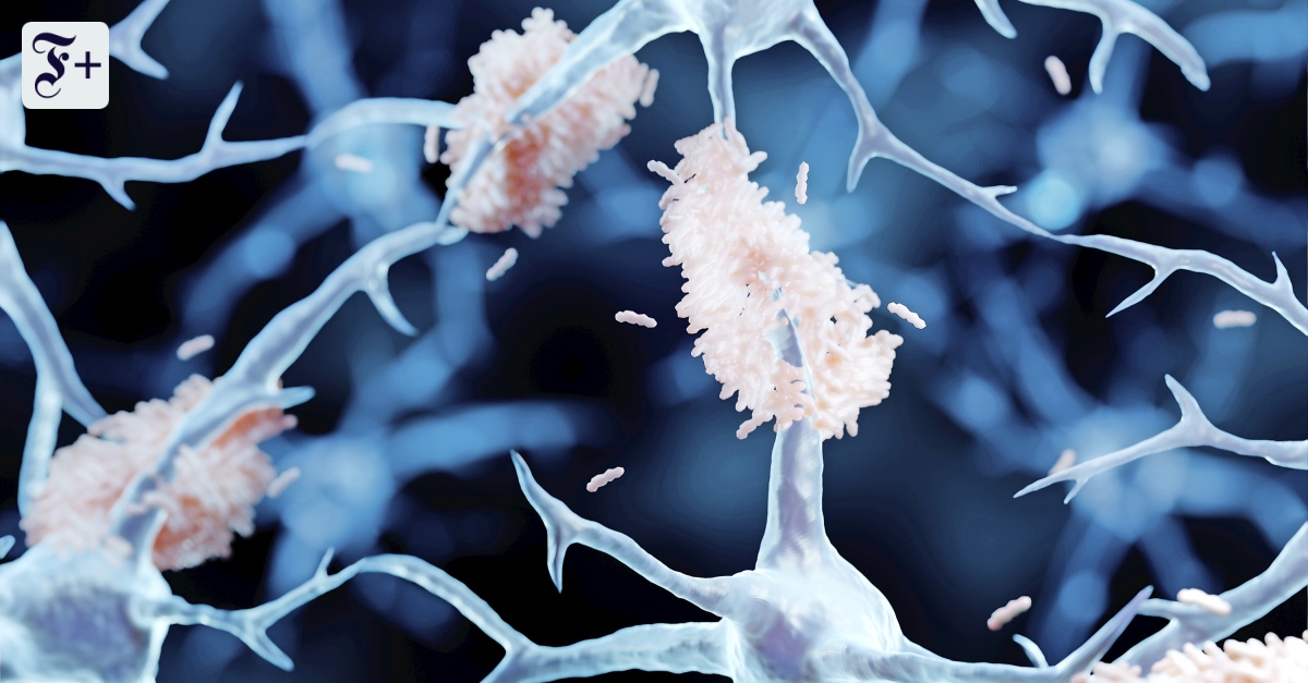 Durchbruch In Der Alzheimer Forschung Was Lithiummangel Für Ihre Zukunft Bedeutet - qe5o7vj