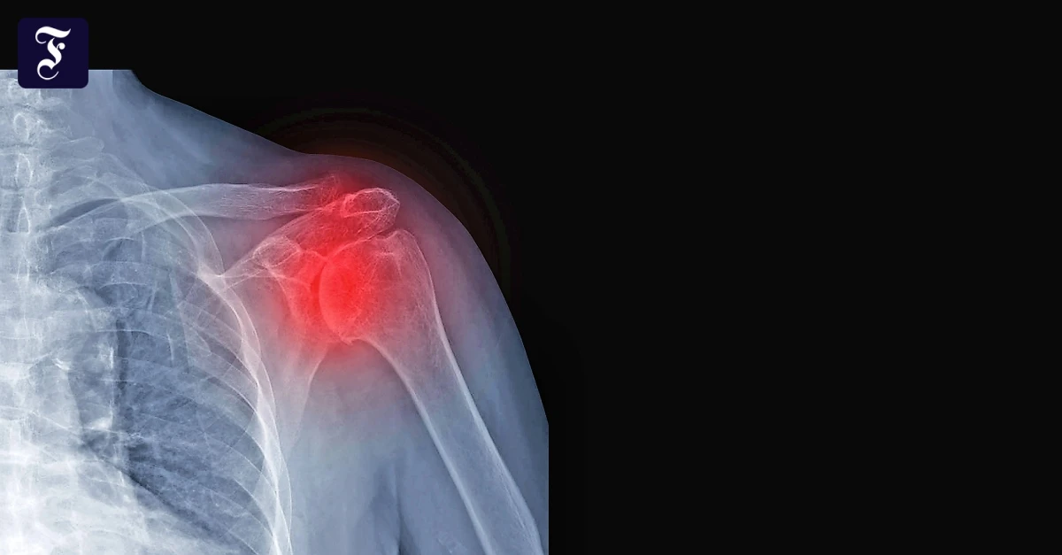 Chronische-Schmerzen-Rheuma-ist-keine-Frage-des-Alters