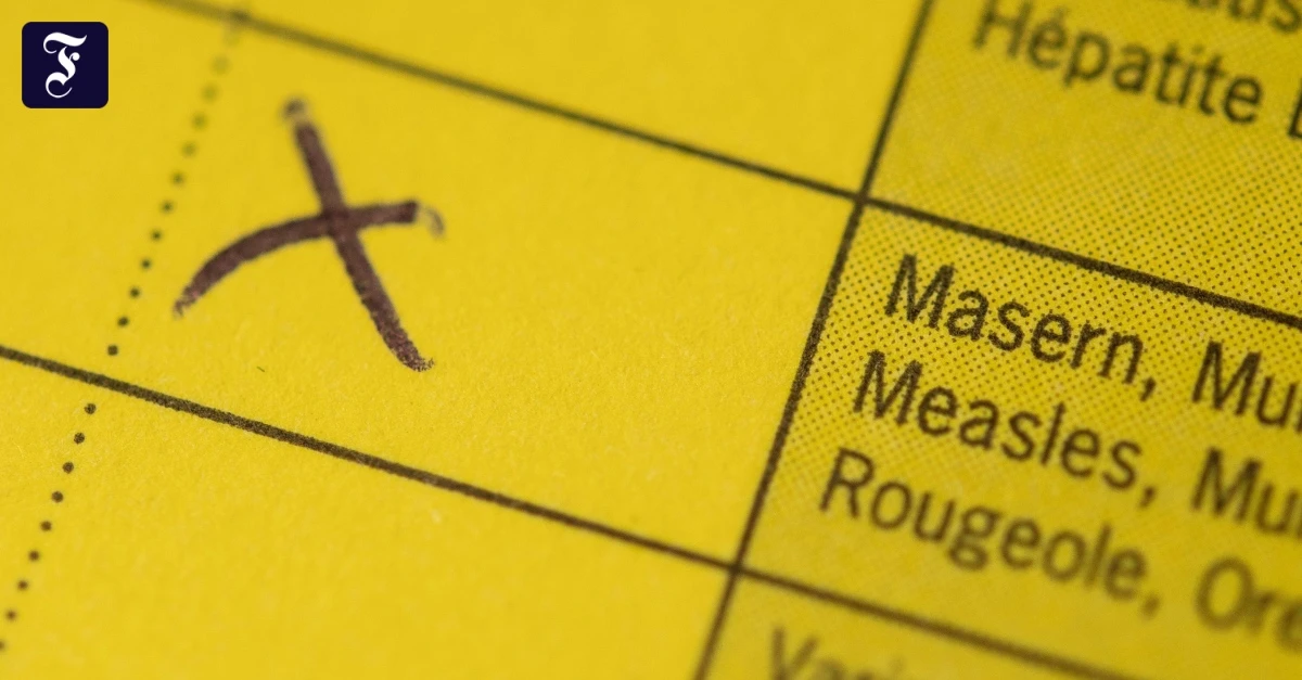 16 Menschen erkrankt: Masern in Freikirche in Karlsruhe ausgebrochen